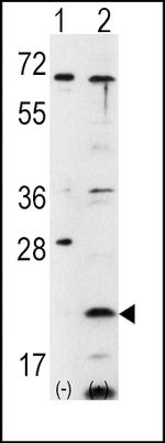 FXN Antibody in Western Blot (WB)