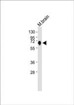 Nurr1 Antibody in Western Blot (WB)