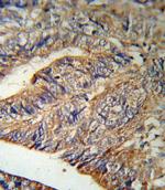 IL1RA Antibody in Immunohistochemistry (Paraffin) (IHC (P))