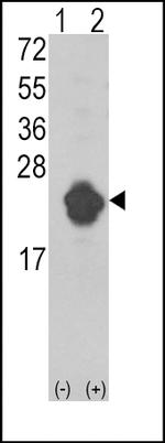 IL1RA Antibody in Western Blot (WB)