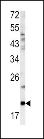 Glucagon Antibody in Western Blot (WB)