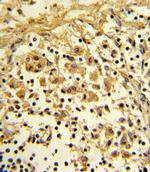 ENO1 Antibody in Immunohistochemistry (Paraffin) (IHC (P))