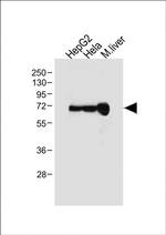 Albumin Antibody in Western Blot (WB)