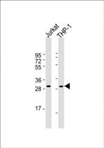 CD154 (CD40 Ligand) Antibody in Western Blot (WB)