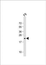 VHL Antibody in Western Blot (WB)