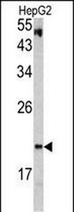 VHL Antibody in Western Blot (WB)