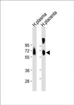 Osteopontin Antibody in Western Blot (WB)