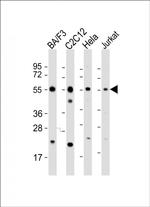 Caspase 8 Antibody in Western Blot (WB)