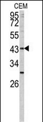 FUT1 Antibody in Western Blot (WB)