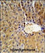 SERPINB3 Antibody in Immunohistochemistry (Paraffin) (IHC (P))