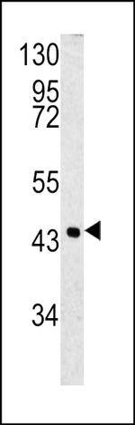 SERPINB3 Antibody in Western Blot (WB)