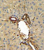 Annexin V Antibody in Immunohistochemistry (Paraffin) (IHC (P))