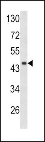 Decorin Antibody in Western Blot (WB)