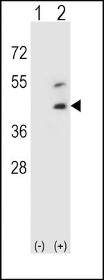 Decorin Antibody in Western Blot (WB)