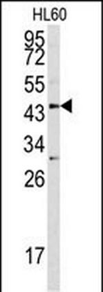 Asporin Antibody in Western Blot (WB)