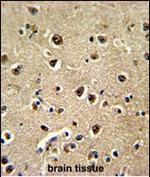 BAALC Antibody in Immunohistochemistry (Paraffin) (IHC (P))