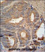 AZGP1 Antibody in Immunohistochemistry (Paraffin) (IHC (P))