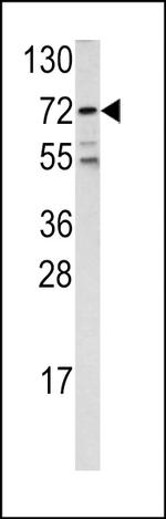 FOXO1 Antibody in Western Blot (WB)