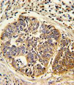 HMGCS1 Antibody in Immunohistochemistry (Paraffin) (IHC (P))