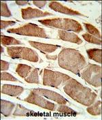 TAGLN Antibody in Immunohistochemistry (Paraffin) (IHC (P))