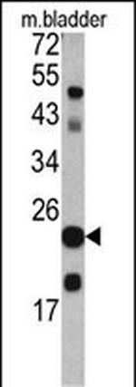 TAGLN Antibody in Western Blot (WB)