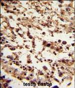 TBP Antibody in Immunohistochemistry (Paraffin) (IHC (P))