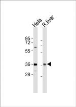 PAX4 Antibody in Western Blot (WB)