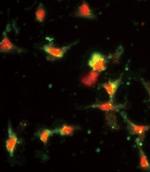 MCP-1 Antibody in Immunocytochemistry (ICC/IF)