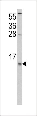 MCP-1 Antibody in Western Blot (WB)