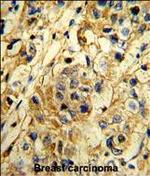 TIMP1 Antibody in Immunohistochemistry (Paraffin) (IHC (P))