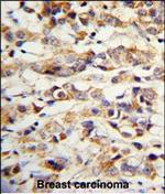 Cytokeratin 14 Antibody in Immunohistochemistry (Paraffin) (IHC (P))