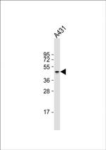 Cytokeratin 14 Antibody in Western Blot (WB)