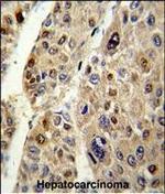 SERPINC1 Antibody in Immunohistochemistry (Paraffin) (IHC (P))