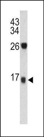 DCD Antibody in Western Blot (WB)