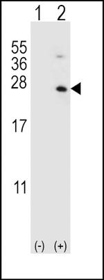 HPRT1 Antibody in Western Blot (WB)