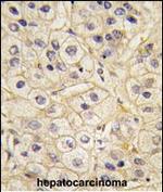 GRK1 Antibody in Immunohistochemistry (Paraffin) (IHC (P))