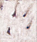 PKC beta-2 Antibody in Immunohistochemistry (Paraffin) (IHC (P))