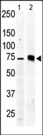 PKC beta-2 Antibody in Western Blot (WB)