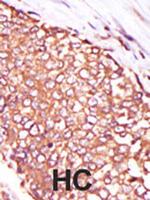 PKC theta Antibody in Immunohistochemistry (Paraffin) (IHC (P))