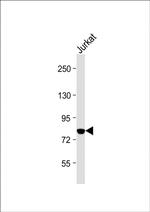 PKC theta Antibody in Western Blot (WB)