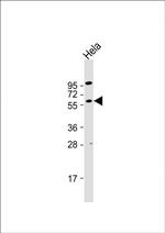 AKT2 Antibody in Western Blot (WB)