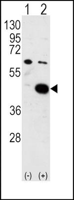 PDK2 Antibody in Western Blot (WB)