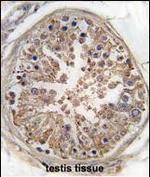 AMPK gamma-1 Antibody in Immunohistochemistry (Paraffin) (IHC (P))