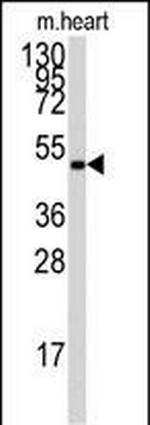 AMPK gamma-1 Antibody in Western Blot (WB)