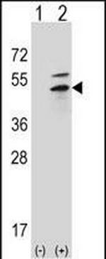 PRKAR2B Antibody in Western Blot (WB)