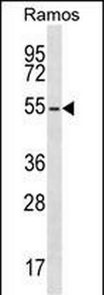 PRKAR2B Antibody in Western Blot (WB)