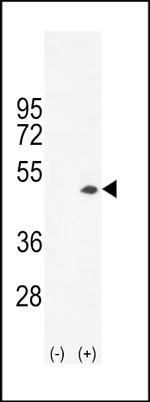 Creatine Kinase BB Antibody in Western Blot (WB)