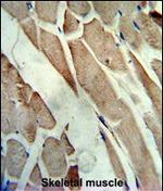 Creatine Kinase MB Antibody in Immunohistochemistry (Paraffin) (IHC (P))