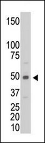 Creatine Kinase MB Antibody in Western Blot (WB)