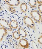 PGK1 Antibody in Immunohistochemistry (Paraffin) (IHC (P))